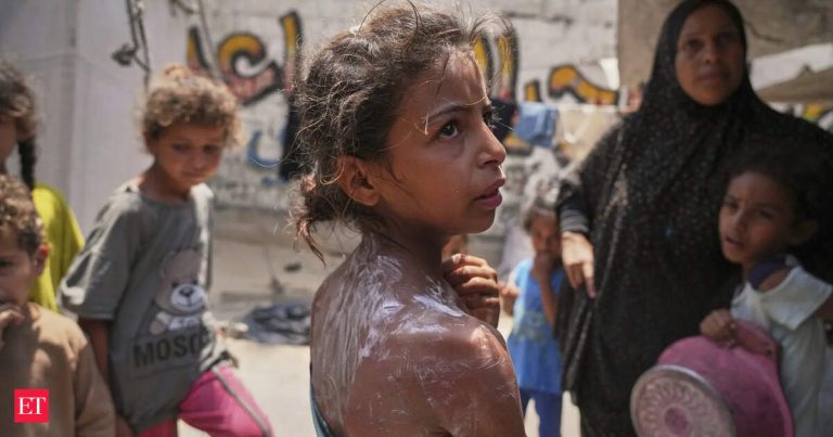 36 Palestinians killed trying to obtain desperately needed aid in Gaza, officials say