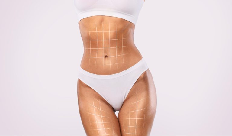 Liposuction Near Me: What to Expect from Local Body Contouring Experts