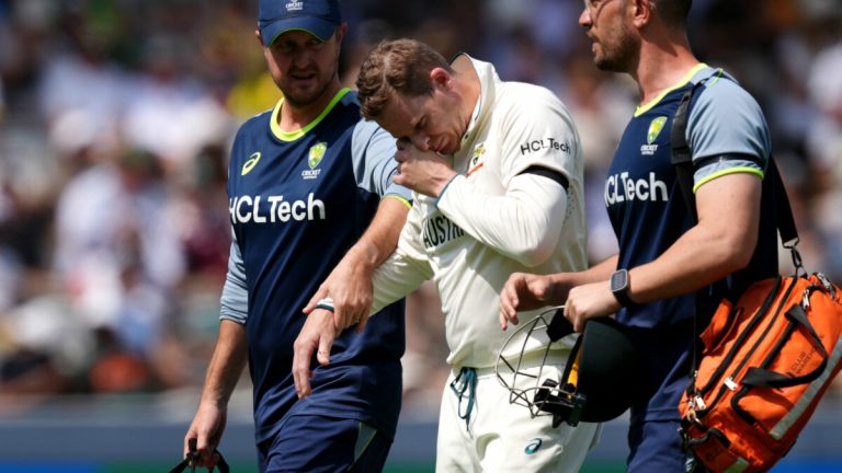 Windies tour fears for Smith as gruesome finger injury confirmed